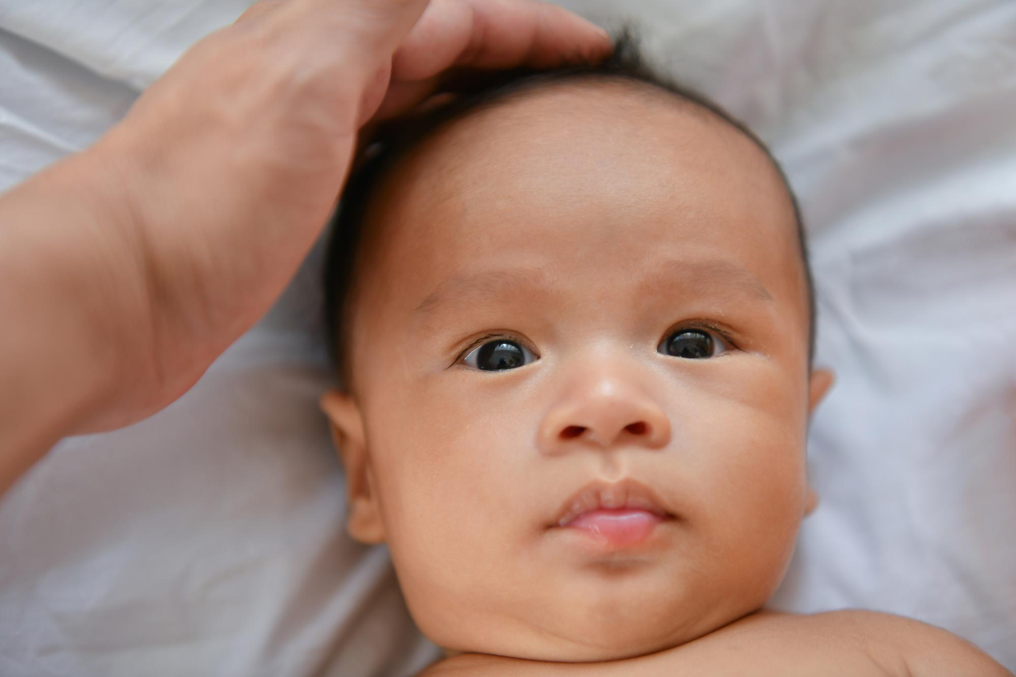 Newborn baby being examined for jaundice by pressing gently on forehead to check skin coloring